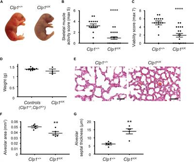 Reduced Prenatal Pulmonary Lymphatic Function Is Observed in Clp1K/K Embryos With Impaired Motor Functions Including Fetal Breathing Movements in Preparation of the Developing Lung for Inflation at Birth